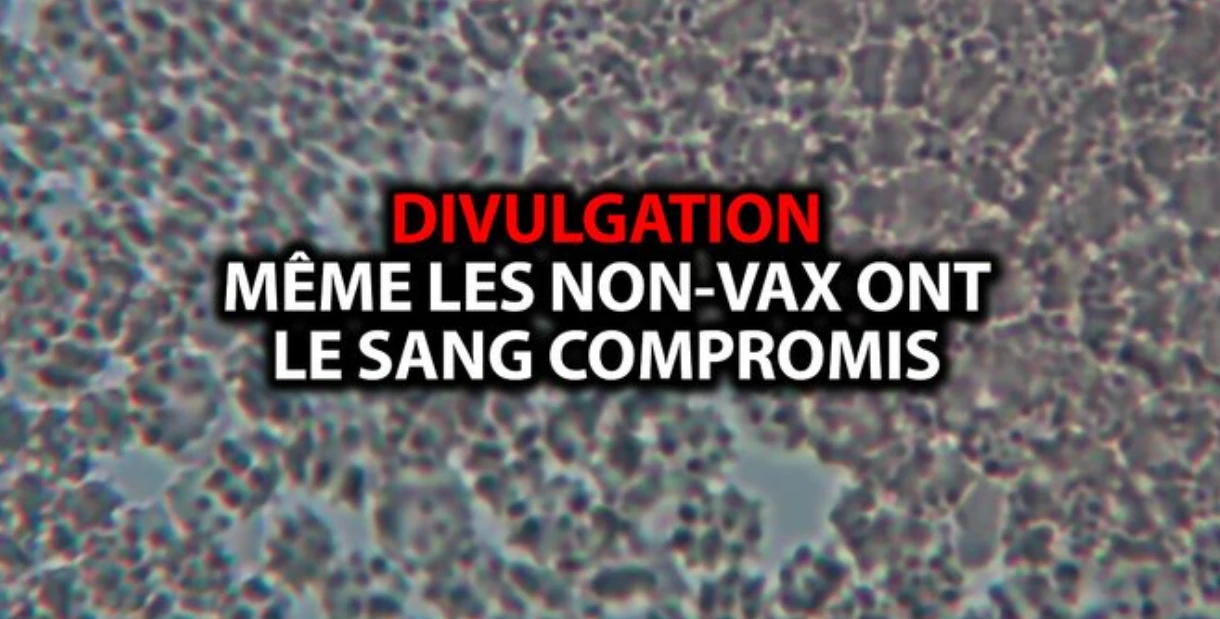 LuxMedia : RÉINFORMATION 10/03/2023 – DIVULGATION: MÊME LES NON-VACCINÉS ONT LE SANG COMPROMIS